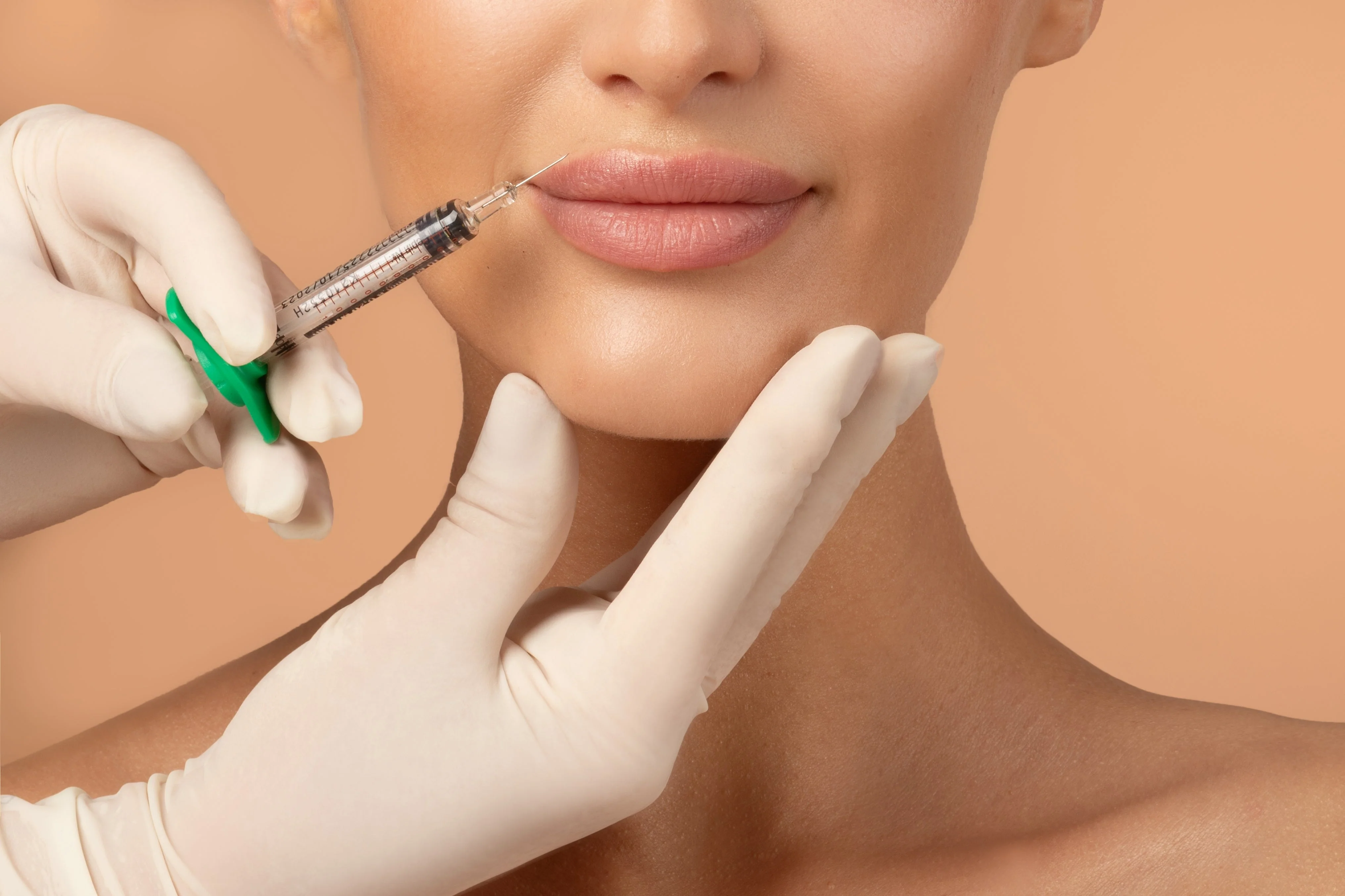 Dermal Fillers